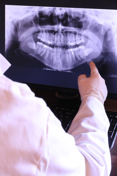 Emergency Dental Filling Replacement in VA